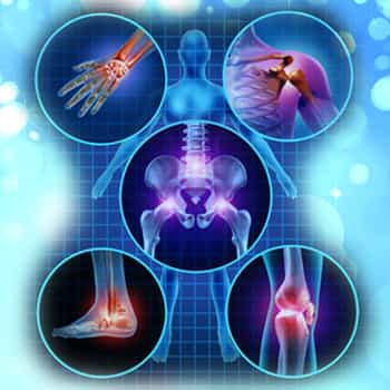 Things to Know When Considering Stem Cell Therapy for Arthritis in Mexico